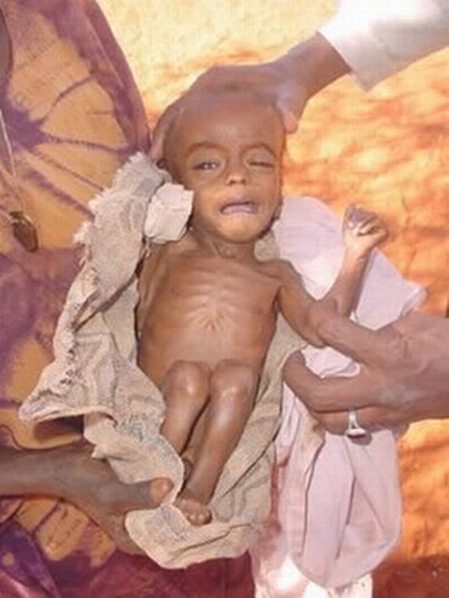 Chùm ảnh những đứa trẻ châu Phi gầy trơ xương vì đói sẽ khiến bạn không dám bỏ thừa đồ ăn thêm nữa - Ảnh 10.