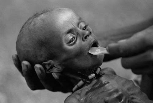 Chùm ảnh những đứa trẻ châu Phi gầy trơ xương vì đói sẽ khiến bạn không dám bỏ thừa đồ ăn thêm nữa - Ảnh 17.