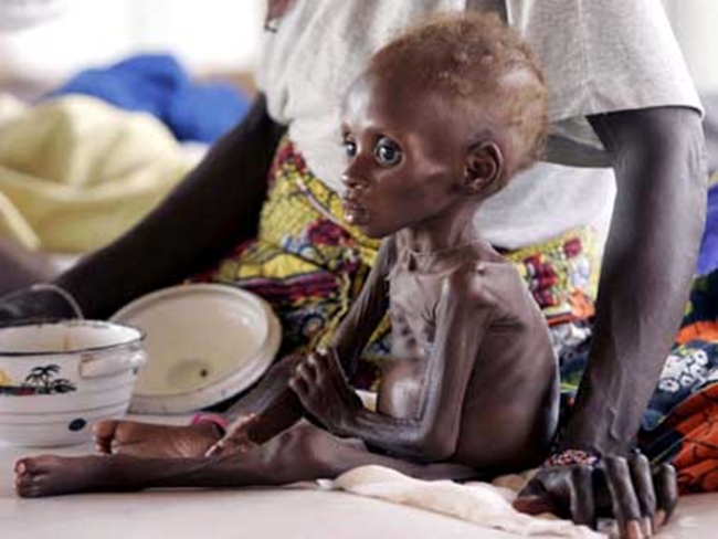Chùm ảnh những đứa trẻ châu Phi gầy trơ xương vì đói sẽ khiến bạn không dám bỏ thừa đồ ăn thêm nữa - Ảnh 24.