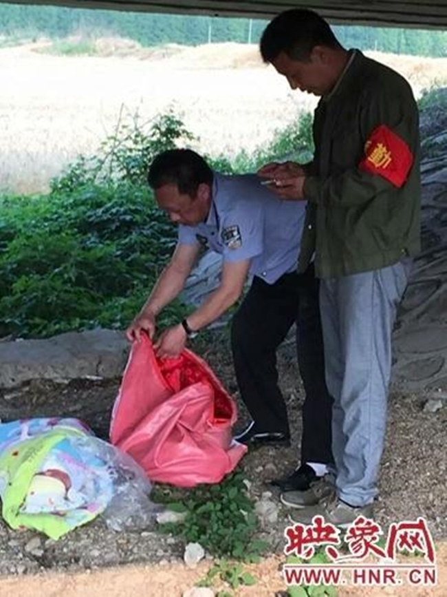 Gương mặt chi ch&iacute;t vết thương v&igrave; c&ocirc;n tr&ugrave;ng cắn của đứa trẻ bị bỏ rơi dưới gầm cầu - Ảnh 2.