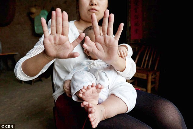 Cha mẹ cầu cứu vì con trai chào đời với 15 ngón tay và 16 ngón chân - Ảnh 4.