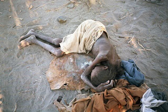 Chùm ảnh những đứa trẻ châu Phi gầy trơ xương vì đói sẽ khiến bạn không dám bỏ thừa đồ ăn thêm nữa - Ảnh 25.