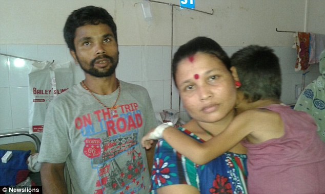 Ấn Độ: Cậu bé đáng thương mắc bệnh lạ, mắt lồi như sắp rớt ra ngoài - Ảnh 3.