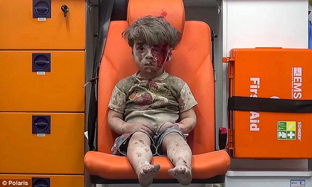 24 giờ sau hình ảnh cậu bé Syria bị không kích, một nạn nhân nhỏ tuổi khác lại khiến thế giới bàng hoàng - Ảnh 2.