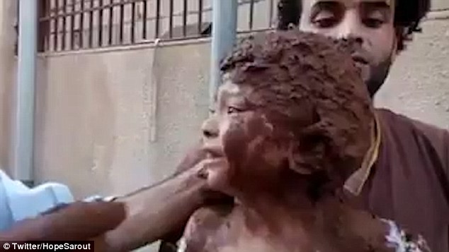 Đây là Syria, không phải Việt Nam - Loạt ảnh xé lòng về những đứa trẻ bị thiêu đốt trong trận không kích bằng napalm - Ảnh 5.