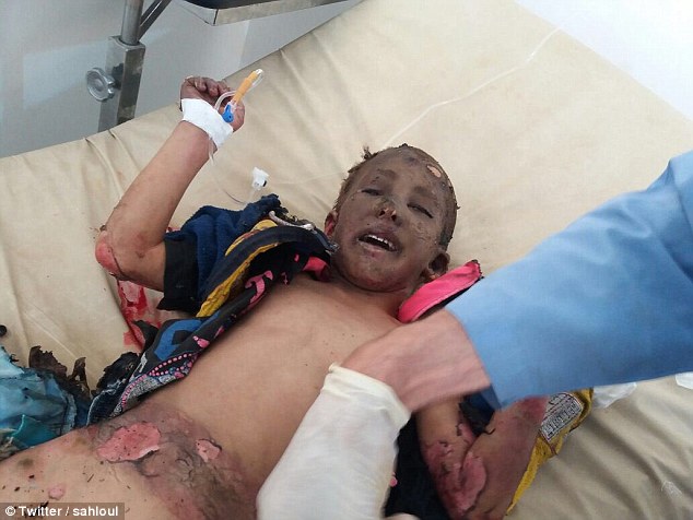 Đây là Syria, không phải Việt Nam - Loạt ảnh xé lòng về những đứa trẻ bị thiêu đốt trong trận không kích bằng napalm - Ảnh 2.