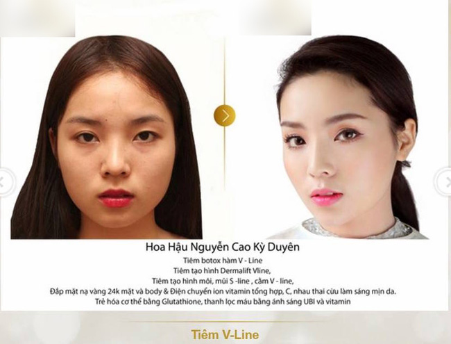 Kỳ Duy&ecirc;n l&agrave; Hoa hậu nhiều thị phi nhất lịch sử showbiz Việt? - Ảnh 6.