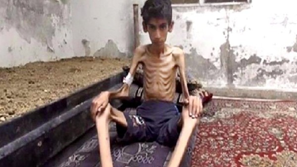 Cả thế giới bàng hoàng trước đoạn clip cho thấy nạn đói kinh hoàng ở Syria - Ảnh 4.