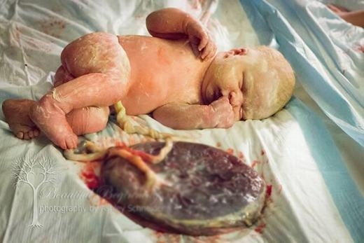 Mốt sinh con kh&ocirc;ng cắt d&acirc;y rốn cho trẻ tr&ecirc;n to&agrave;n thế giới g&acirc;y tranh c&atilde;i - Ảnh 7.