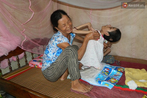 C&ocirc; g&aacute;i mắc bệnh lạ suốt 26 năm nằm một chỗ, lở lo&eacute;t khắp người - Ảnh 1.