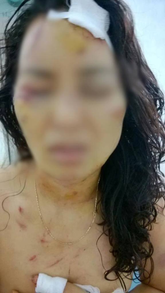 Phú Thọ: Cô giáo trẻ bị chồng đánh đập thương tích đầy người - Ảnh 2.