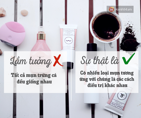 Bỏ ngay 6 lầm tưởng này nếu muốn trị mụn dứt điểm, hiệu quả - Ảnh 2. Bỏ ngay 6 lầm tưởng này nếu muốn trị mụn dứt điểm, hiệu quả - Ảnh 2.