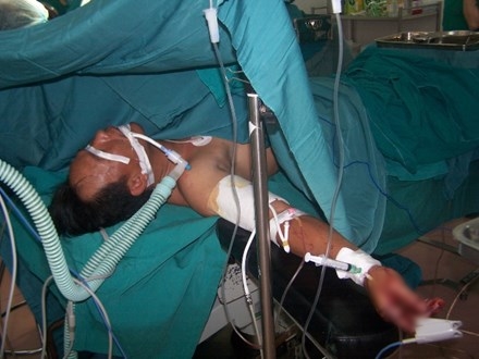 Người đ&agrave;n &ocirc;ng bị ch&eacute;m rớt c&aacute;nh tay xuống đất - Ảnh 1.