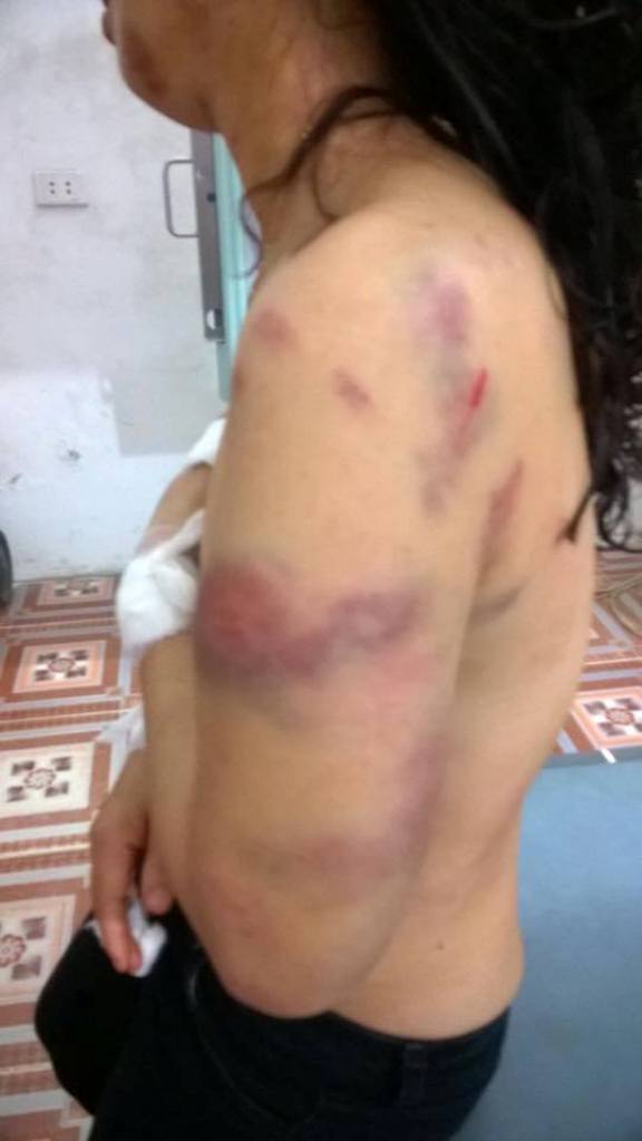 Phú Thọ: Cô giáo trẻ bị chồng đánh đập thương tích đầy người - Ảnh 3.