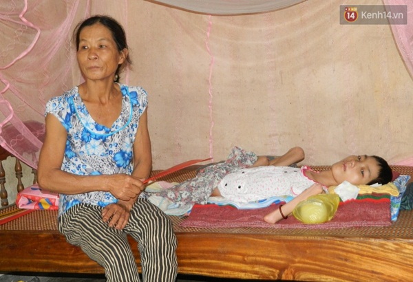C&ocirc; g&aacute;i mắc bệnh lạ suốt 26 năm nằm một chỗ, lở lo&eacute;t khắp người - Ảnh 3.