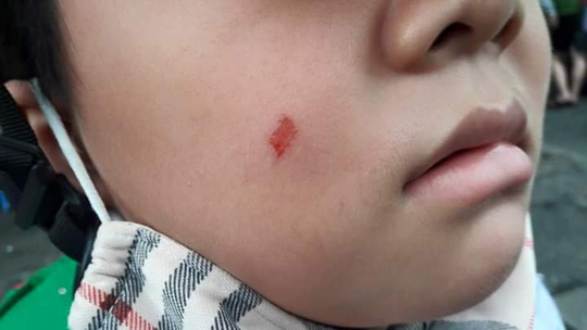 Phụ huynh vào trường tát cô giáo bị phạt 7 triệu đồng - Ảnh 2.
