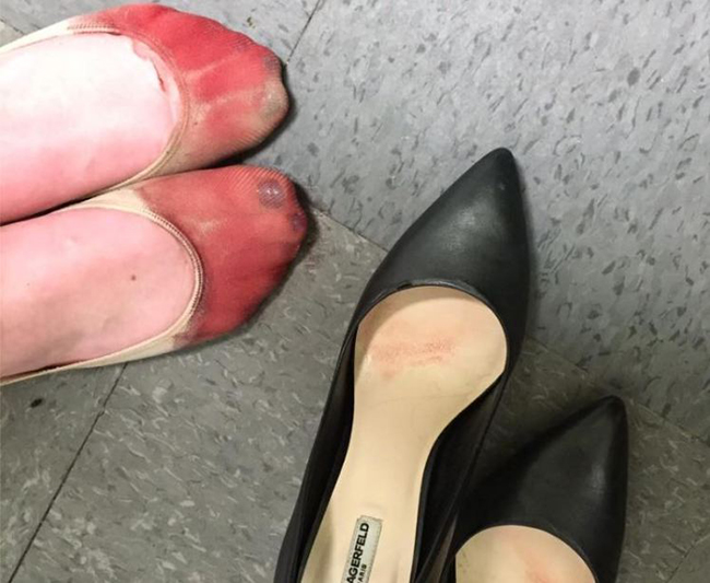 Nữ phục vụ bàn chia sẻ đôi chân rướm máu sau một ngày làm việc trên giày cao gót - Ảnh 1.