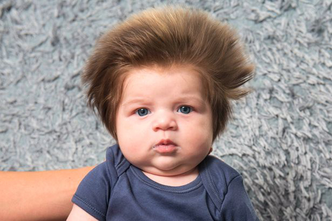 Em bé tóc điện giật bẩm sinh trở thành cảm hứng của các thợ chế ảnh dạo tâm huyết với nghề - Ảnh 1.