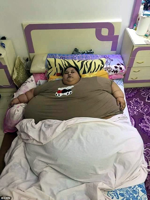 Nặng nửa tấn, người phụ nữ nằm bất động tr&ecirc;n giường suốt 25 năm nay - Ảnh 1.