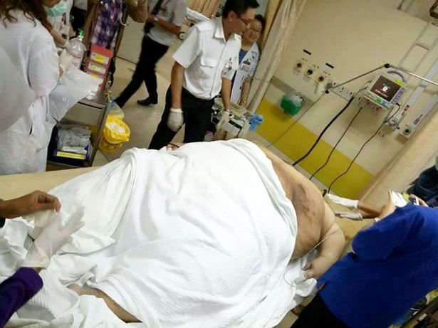 Tr&aacute;ng miệng 30 b&aacute;t m&igrave; mỗi ng&agrave;y, ch&agrave;ng b&eacute;o 250kg giờ đ&atilde; kh&ocirc;ng cử động được - Ảnh 3.