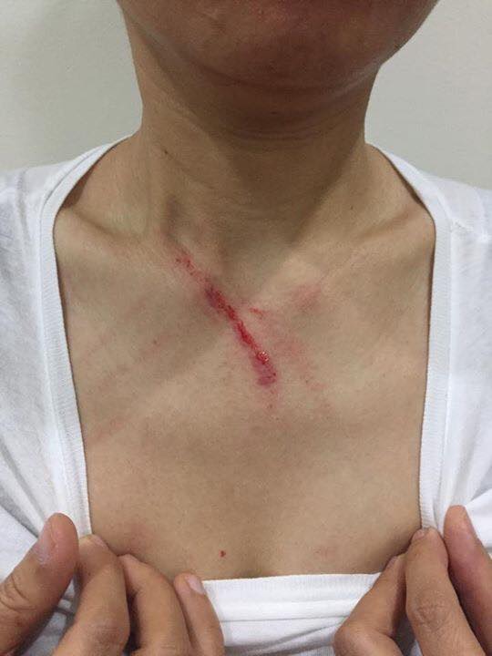 Hà Nội: Khuyên không nhổ nước bọt nơi công cộng, một phụ nữ bị đánh trong thang máy - Ảnh 1.