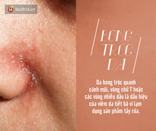 Những dấu hiệu cho thấy bạn đang l&agrave;m hỏng da v&igrave; rửa mặt qu&aacute; nhiều - Ảnh 2.