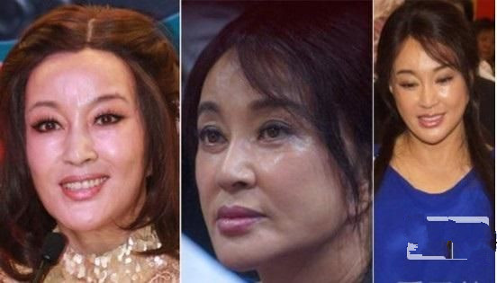 Những mỹ nh&acirc;n ch&acirc;u &Aacute; đang phải trả gi&aacute; đắt v&igrave; chạy theo phẫu thuật thẩm mỹ - Ảnh 24.