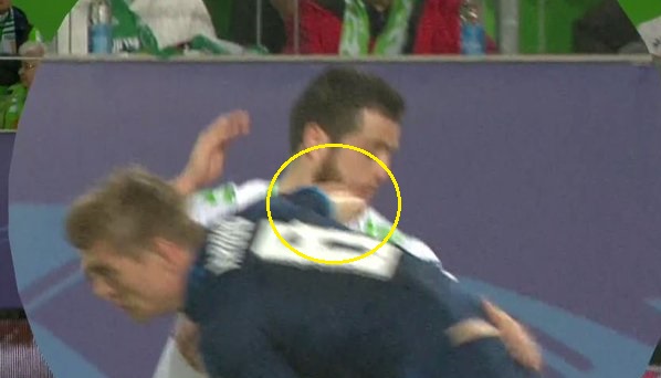 Cầu thủ Wolfsburg g&atilde;y răng sau pha va chạm với Toni Kroos - Ảnh 2.