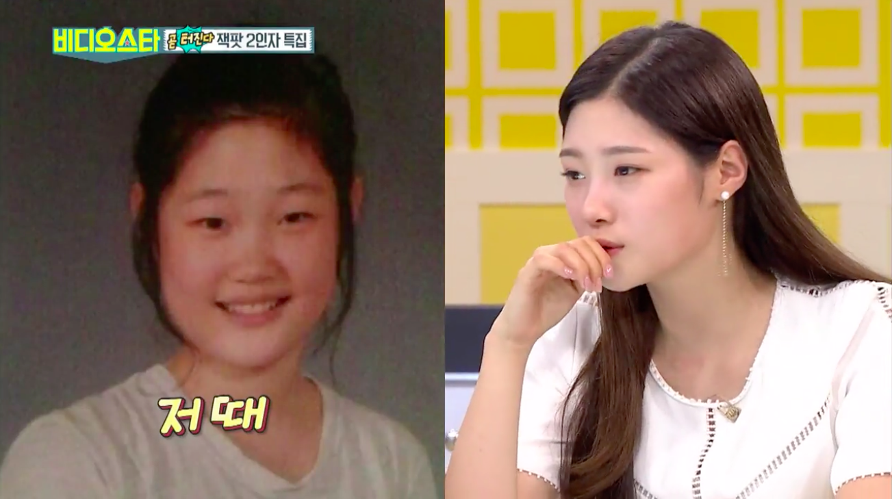 Jung Chaeyeon Predebut. Chaewon Izone before Plastic Surgery.