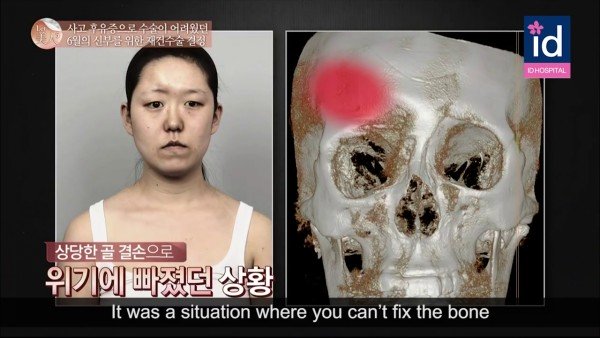 Từng l&otilde;m tr&aacute;n, lệch một nửa mặt, nhưng c&ocirc; g&aacute;i n&agrave;y đ&atilde; ho&aacute; thi&ecirc;n nga chỉ sau 64 ng&agrave;y! - Ảnh 7.
