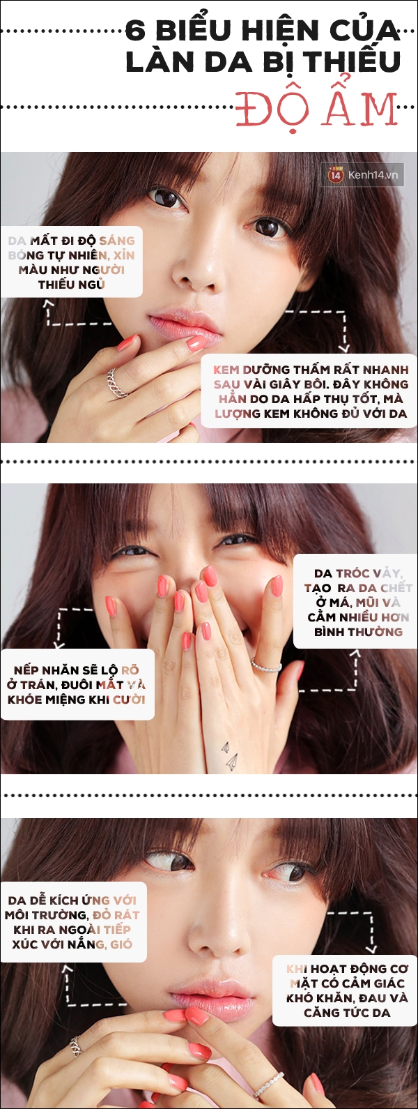 Nhận biết ngay khi l&agrave;n da của bạn bị thiếu độ ẩm nghi&ecirc;m trọng - Ảnh 1.