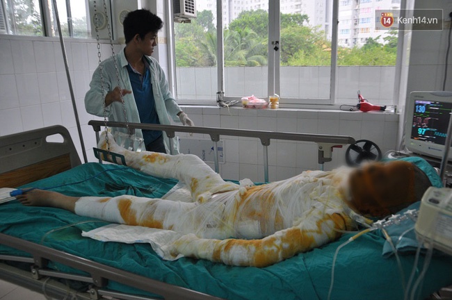 Bố của cô gái xinh đẹp bị bỏng nặng: “Con tôi bảo nó sợ cụt hết tay, thành dị dạng không ai dám đến gần” - Ảnh 5.