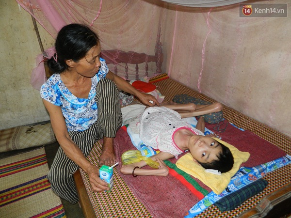 C&ocirc; g&aacute;i mắc bệnh lạ suốt 26 năm nằm một chỗ, lở lo&eacute;t khắp người - Ảnh 4.