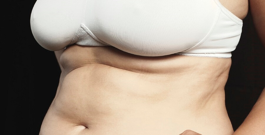 Xác định 3 loại mỡ thừa phổ biến và cách giảm cân hiệu quả nhất dành cho bạn - Ảnh 3. Xác định 3 loại mỡ thừa phổ biến và cách giảm cân hiệu quả nhất dành cho bạn - Ảnh 3.