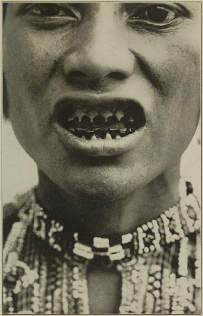 Mài răng, đục mũi... là cách mà phụ nữ đã làm để tránh bị xâm hại tình dục - Ảnh 4.