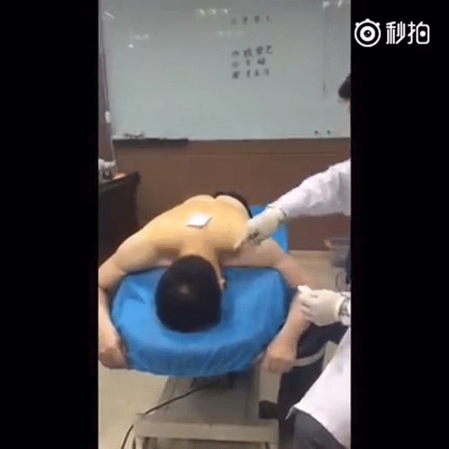 Video: Màn châm cứu bằng kim tiêm voi khiến bất cứ ai cũng phải toát mồ hôi - Ảnh 2. Video: Màn châm cứu bằng kim tiêm voi khiến bất cứ ai cũng phải toát mồ hôi - Ảnh 2.