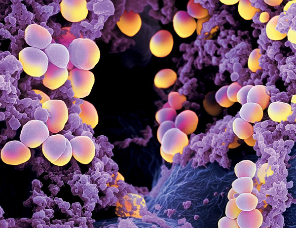 10 vi khuẩn cần phải đề phòng khi thời đại kháng kháng sinh đã đến - Ảnh 3.