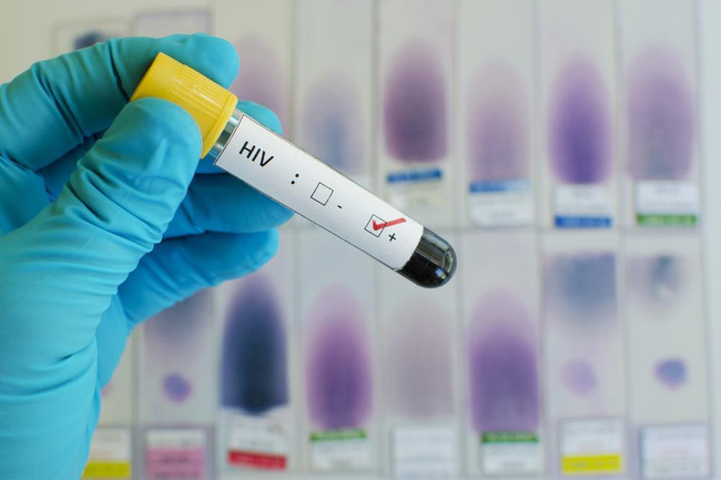 Bắt đầu thử nghiệm vaccine HIV mới - kì vọng sẽ chữa tận gốc căn bệnh thế kỷ - Ảnh 3.