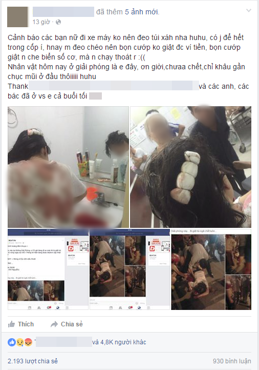 Hà Nội: Cô gái trẻ bị cướp giật túi xách, bất tỉnh trên đường Giải Phóng - Ảnh 2.