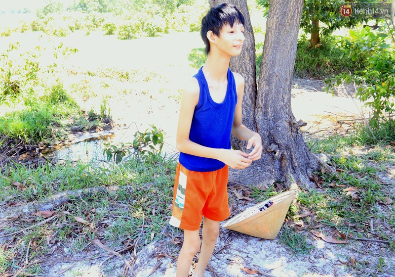 Cuộc sống cùng cực của cậu bé người khỉ 14 tuổi nhưng chỉ cao 0,8 mét, nặng 7kg ở Huế - Ảnh 2. Cuộc sống cùng cực của cậu bé người khỉ 14 tuổi nhưng chỉ cao 0,8 mét, nặng 7kg ở Huế - Ảnh 2.