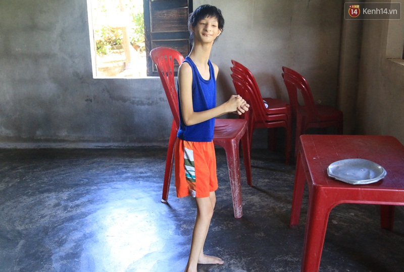Cuộc sống cùng cực của cậu bé người khỉ 14 tuổi nhưng chỉ cao 0,8 mét, nặng 7kg ở Huế - Ảnh 8. Cuộc sống cùng cực của cậu bé người khỉ 14 tuổi nhưng chỉ cao 0,8 mét, nặng 7kg ở Huế - Ảnh 8.