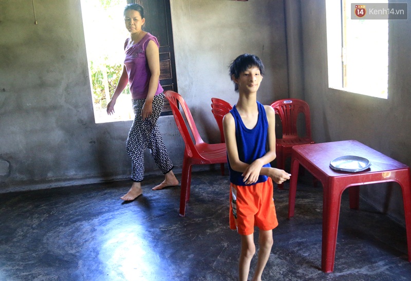 Cuộc sống cùng cực của cậu bé người khỉ 14 tuổi nhưng chỉ cao 0,8 mét, nặng 7kg ở Huế - Ảnh 6. Cuộc sống cùng cực của cậu bé người khỉ 14 tuổi nhưng chỉ cao 0,8 mét, nặng 7kg ở Huế - Ảnh 6.
