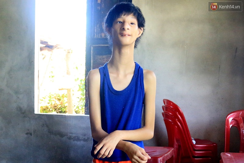 Cuộc sống cùng cực của cậu bé người khỉ 14 tuổi nhưng chỉ cao 0,8 mét, nặng 7kg ở Huế - Ảnh 9. Cuộc sống cùng cực của cậu bé người khỉ 14 tuổi nhưng chỉ cao 0,8 mét, nặng 7kg ở Huế - Ảnh 9.
