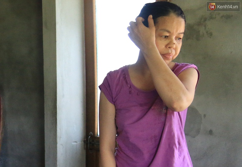 Cuộc sống cùng cực của cậu bé người khỉ 14 tuổi nhưng chỉ cao 0,8 mét, nặng 7kg ở Huế - Ảnh 7. Cuộc sống cùng cực của cậu bé người khỉ 14 tuổi nhưng chỉ cao 0,8 mét, nặng 7kg ở Huế - Ảnh 7.