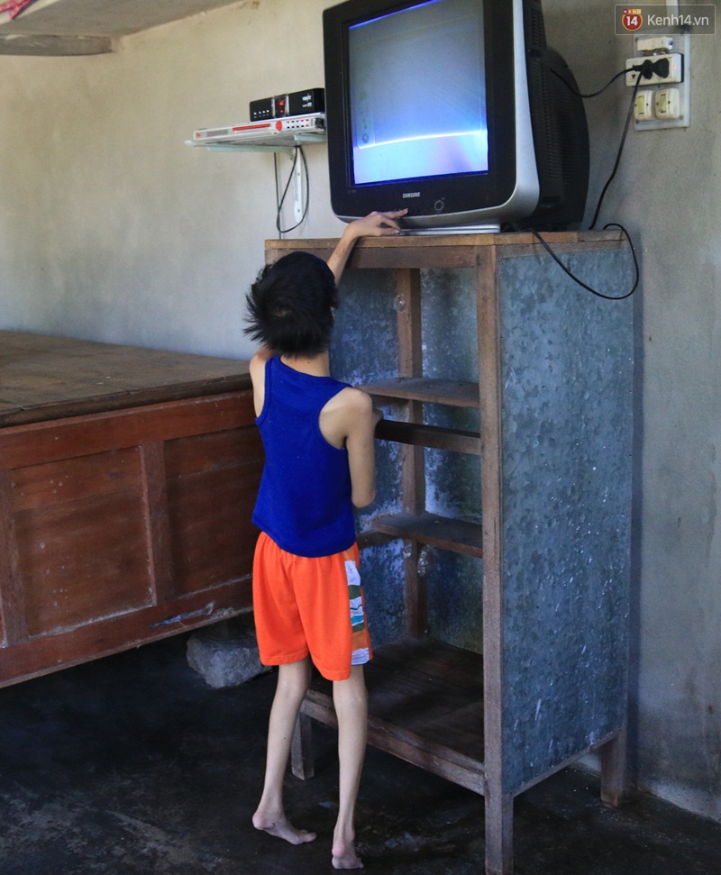 Cuộc sống cùng cực của cậu bé người khỉ 14 tuổi nhưng chỉ cao 0,8 mét, nặng 7kg ở Huế - Ảnh 10. Cuộc sống cùng cực của cậu bé người khỉ 14 tuổi nhưng chỉ cao 0,8 mét, nặng 7kg ở Huế - Ảnh 10.