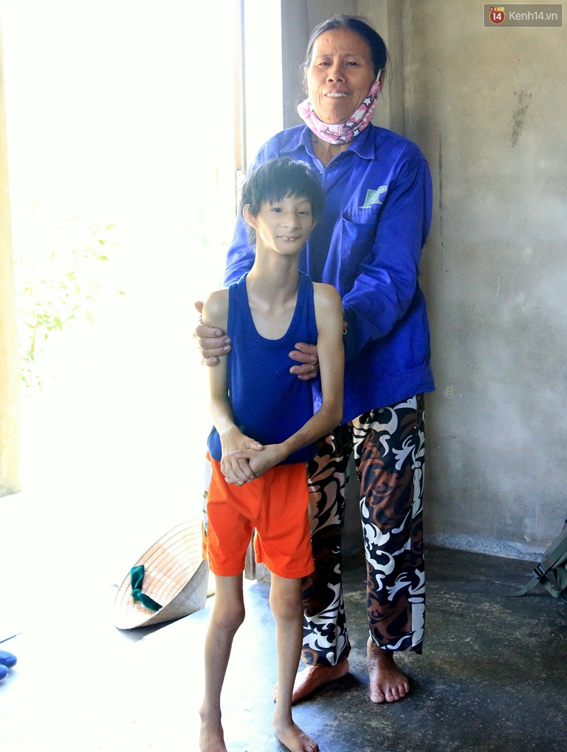 Cuộc sống cùng cực của cậu bé người khỉ 14 tuổi nhưng chỉ cao 0,8 mét, nặng 7kg ở Huế - Ảnh 11. Cuộc sống cùng cực của cậu bé người khỉ 14 tuổi nhưng chỉ cao 0,8 mét, nặng 7kg ở Huế - Ảnh 11.