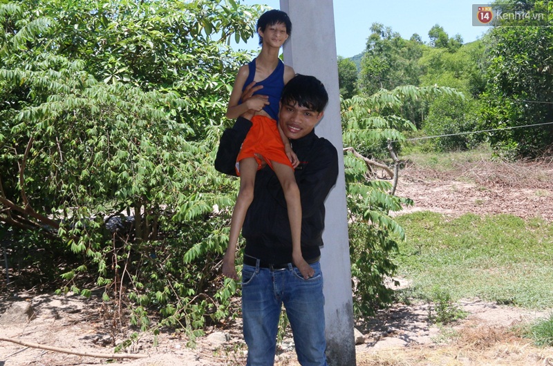 Cuộc sống cùng cực của cậu bé người khỉ 14 tuổi nhưng chỉ cao 0,8 mét, nặng 7kg ở Huế - Ảnh 3. Cuộc sống cùng cực của cậu bé người khỉ 14 tuổi nhưng chỉ cao 0,8 mét, nặng 7kg ở Huế - Ảnh 3.