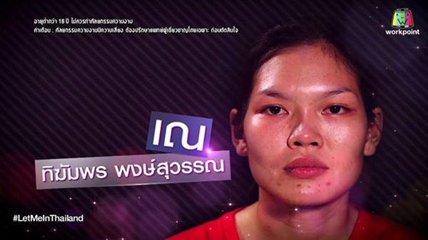 12 màn lột xác kỳ diệu nhờ thẩm mỹ trong chương trình Let me in của Thái Lan  - Ảnh 24.