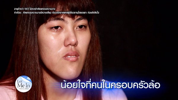 12 màn lột xác kỳ diệu nhờ thẩm mỹ trong chương trình Let me in của Thái Lan  - Ảnh 13.