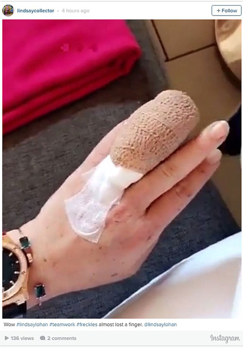 Gặp tai nạn, Lindsay Lohan bị đứt lìa nửa ngón tay áp út - Ảnh 2.